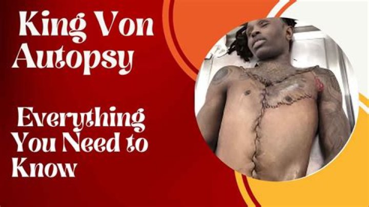 King Von's Autopsy Report: Uncovering The Truth